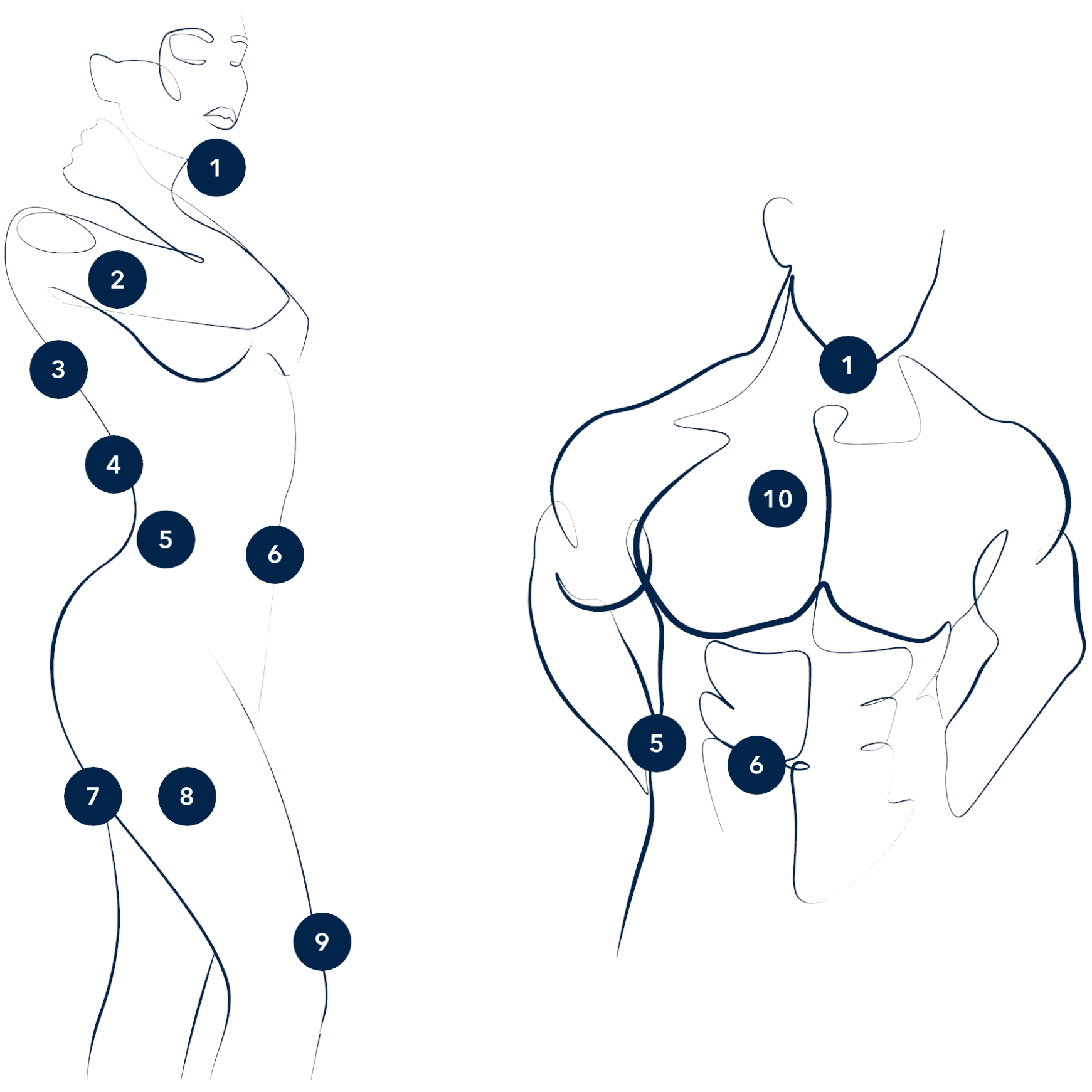 zones du corps traités par la cryolipolyse et Coolsculpting