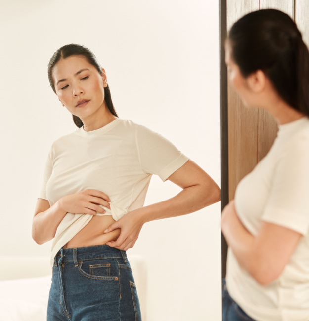 femme brune devant un miroir avant intervention par cryolipolyse de Coolsculpting